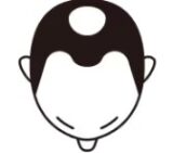 後頭部のイメージ図