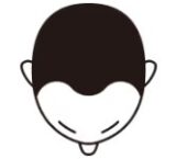 生え際のイメージ図